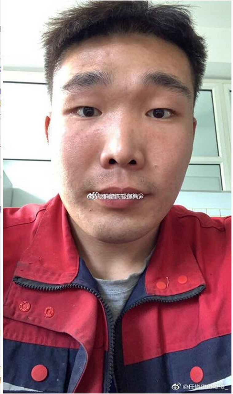 印堂凹陷,这一生的命运只能用糟糕两个字来形容,只能想些方法来冲冲喜