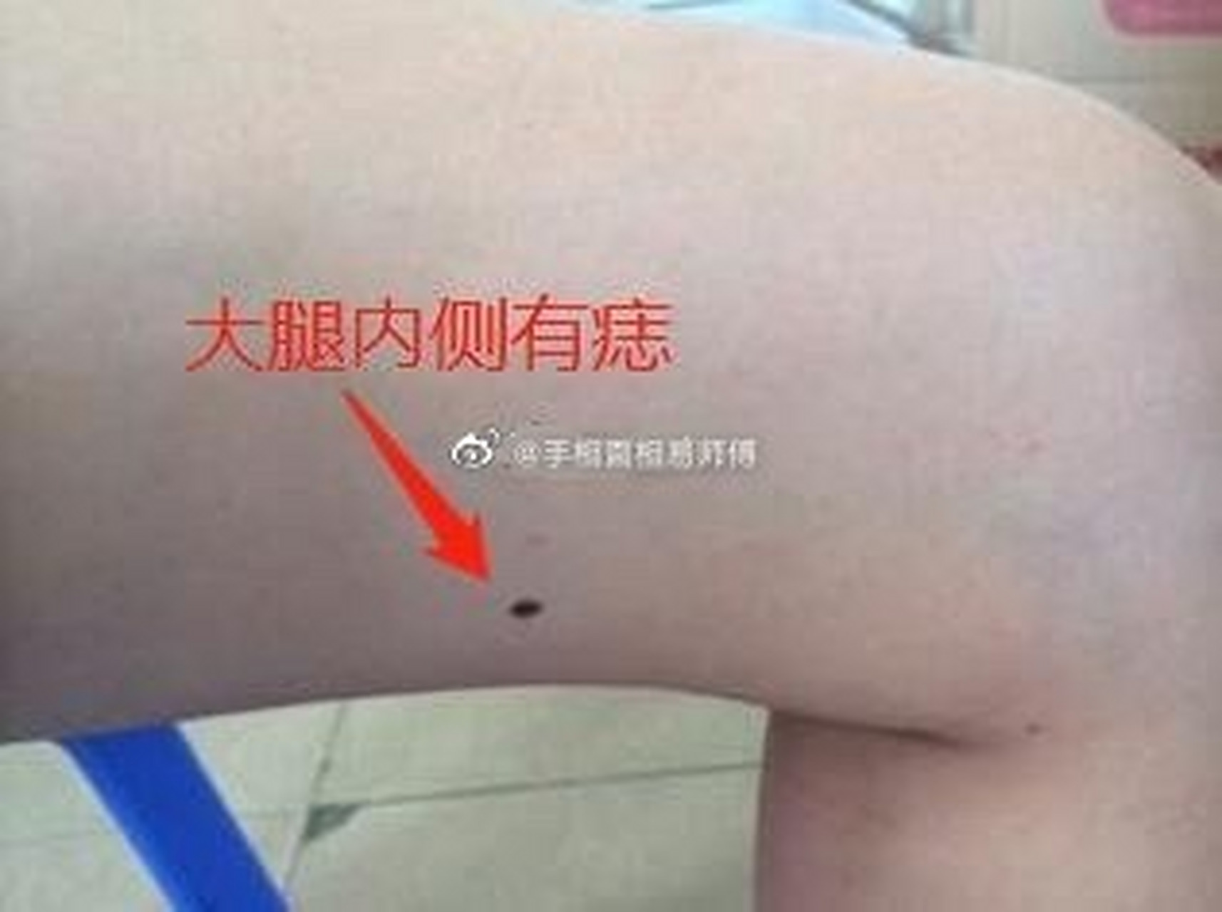 左腿内侧长痣的女人性格外向活泼,右侧长痣的成熟冷静,但是不论左右