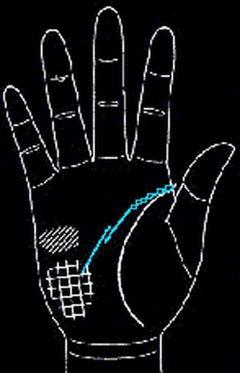 手相三心二意的智慧线;  智慧线起底处呈锁状(如下图):有一心一意