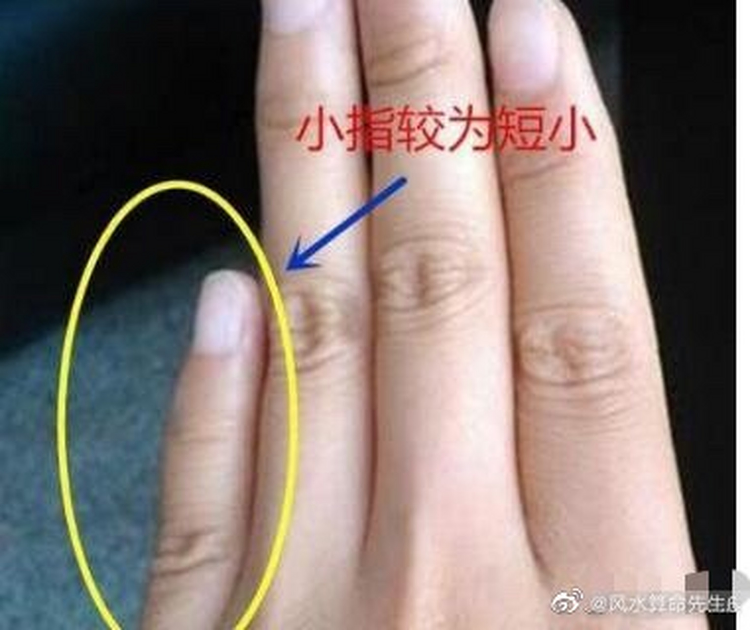 男,手指尖大的叫鼓槌指,这类人天生命局易劳碌辛劳,并且不利贵不利