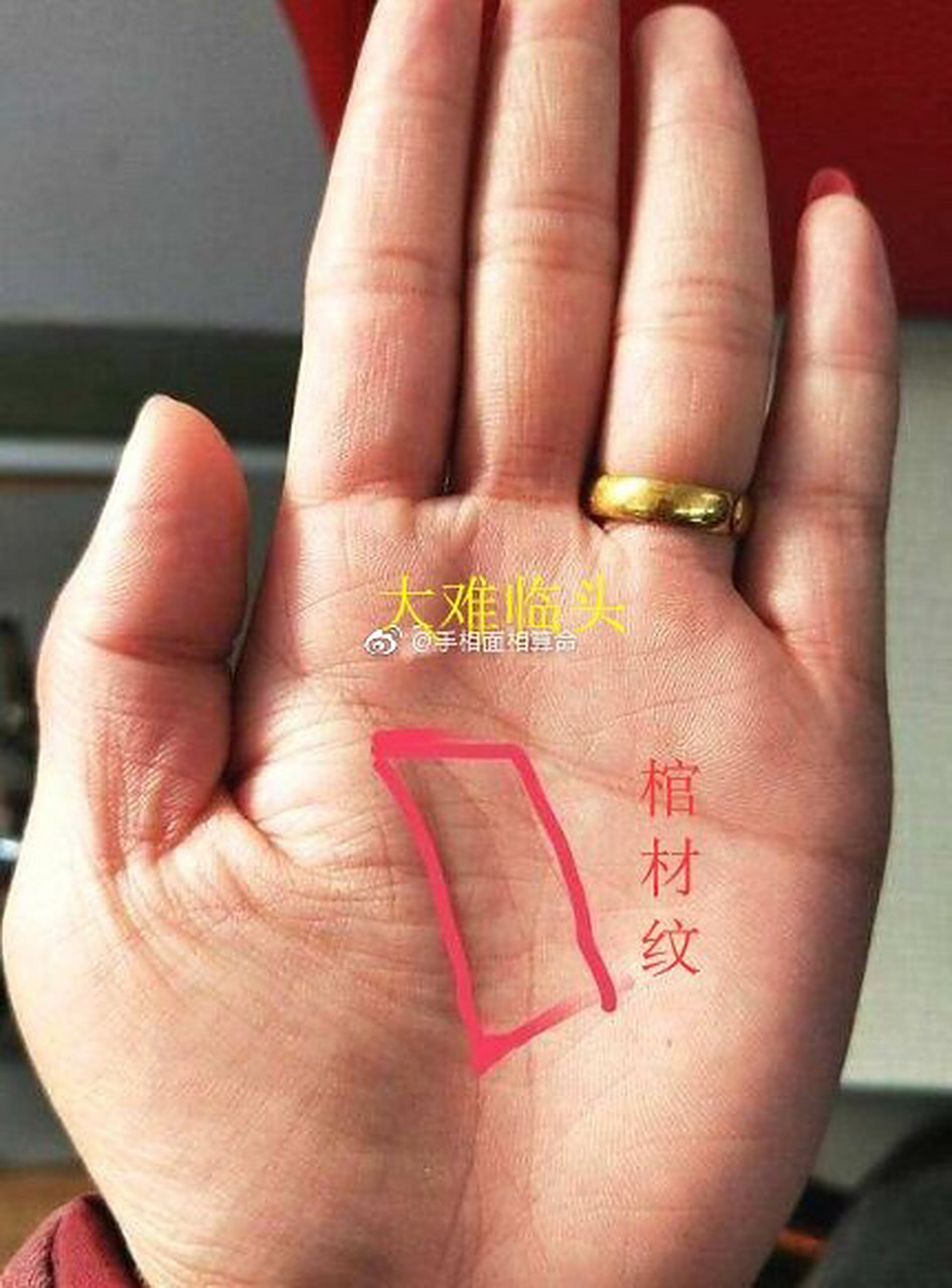 在小鱼际内缘从生命线斜伸向小指下方的长方格形样纹.