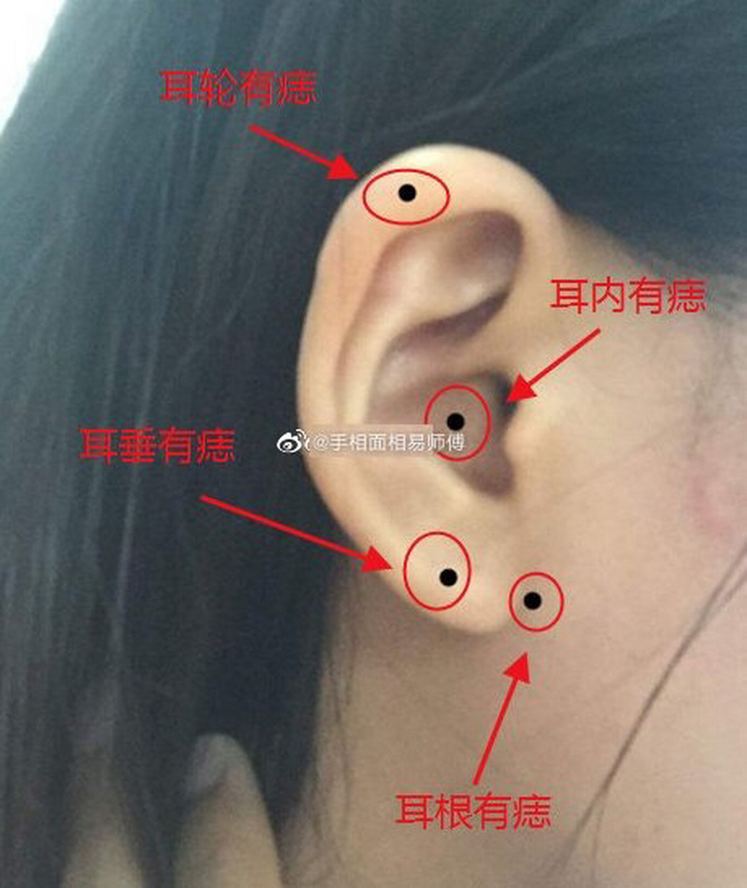 耳痣,也分好坏凶吉 1,耳垂有痣    耳珠有痣者财运不错,但是容易财来