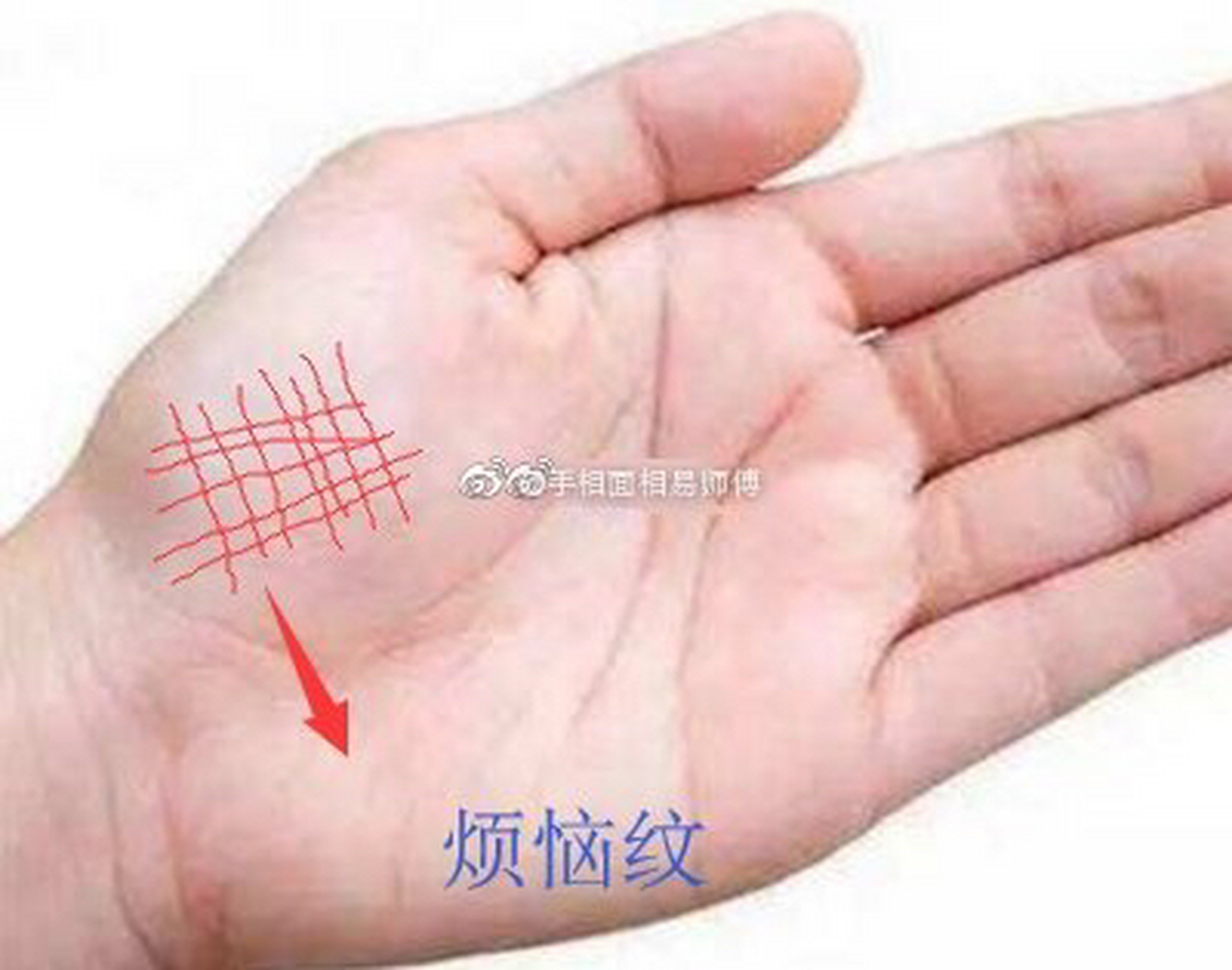 烦恼纹        手中的烦恼纹,位于手中的金星丘(大拇指下)位置,呈网格