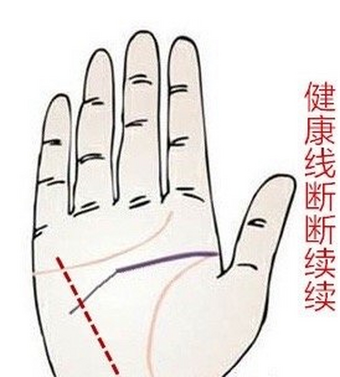 在手相中如果出现了健康线就预示着身体出现问题,不同的健康线代表着