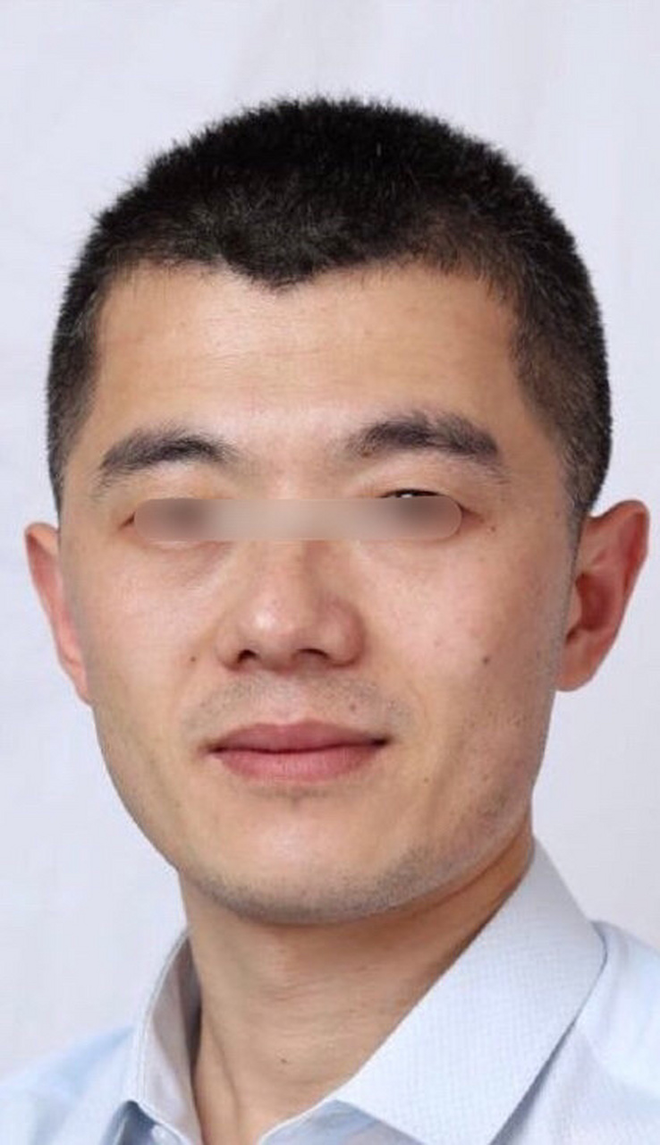 面相分析:  命宫附近有痣,耳朵为鸡嘴耳,略显单薄,抬头纹比较明显.