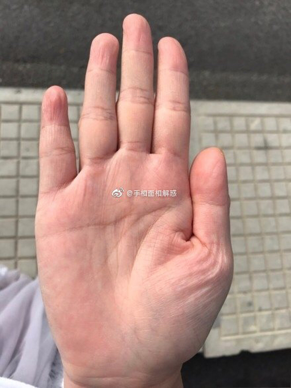 手相面相算命[超话]#从手相来看,3条主线形成了鸡爪纹,有鸡爪纹的人