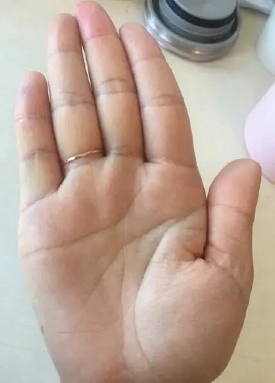 这位女士的手相,m型掌纹,事业线挺直深长,事业心比较重,但感情上容易