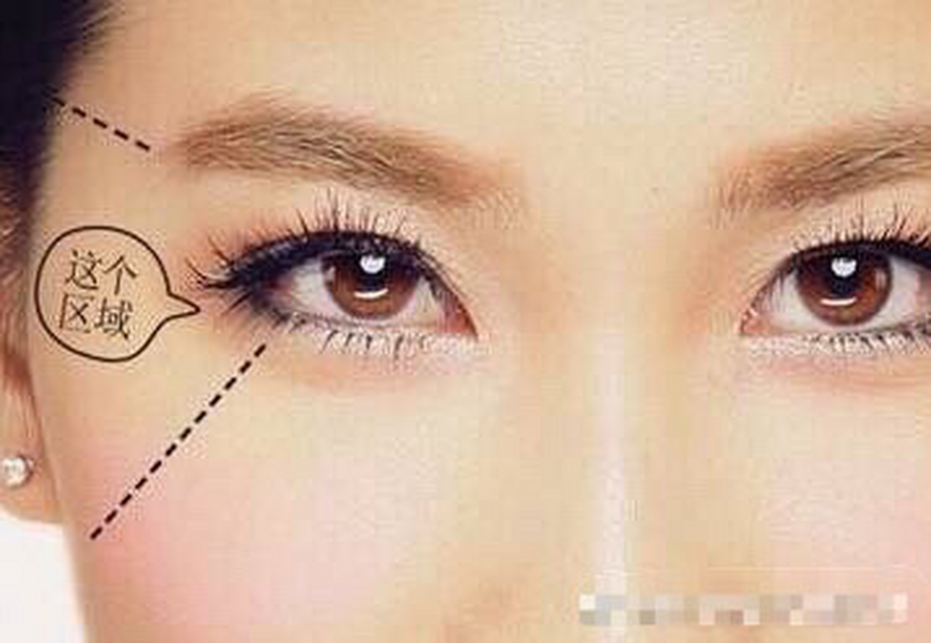 出轨痣  眼尾的位置就是面相中的"奸门",也就是面相十二宫的"夫妻宫"