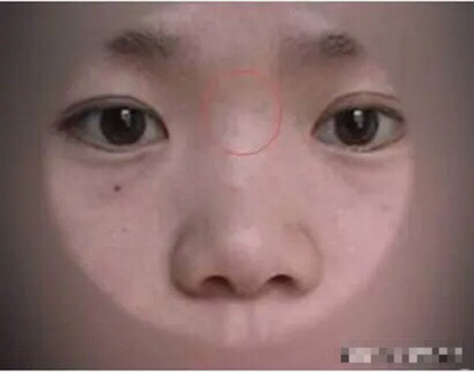 山根两旁为夫妻座,女人山根有横纹,表示性格比较极端,做事比较冲动