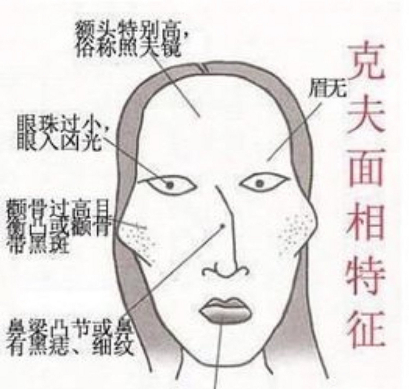 【克夫面相特征 1额头特别高,俗称照夫镜 2无眉.