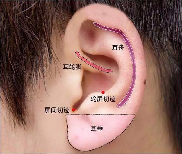 痣的命运图解耳屏上切迹耳屏切迹对耳屏听宫穴位图对耳屏位置图耳屏上