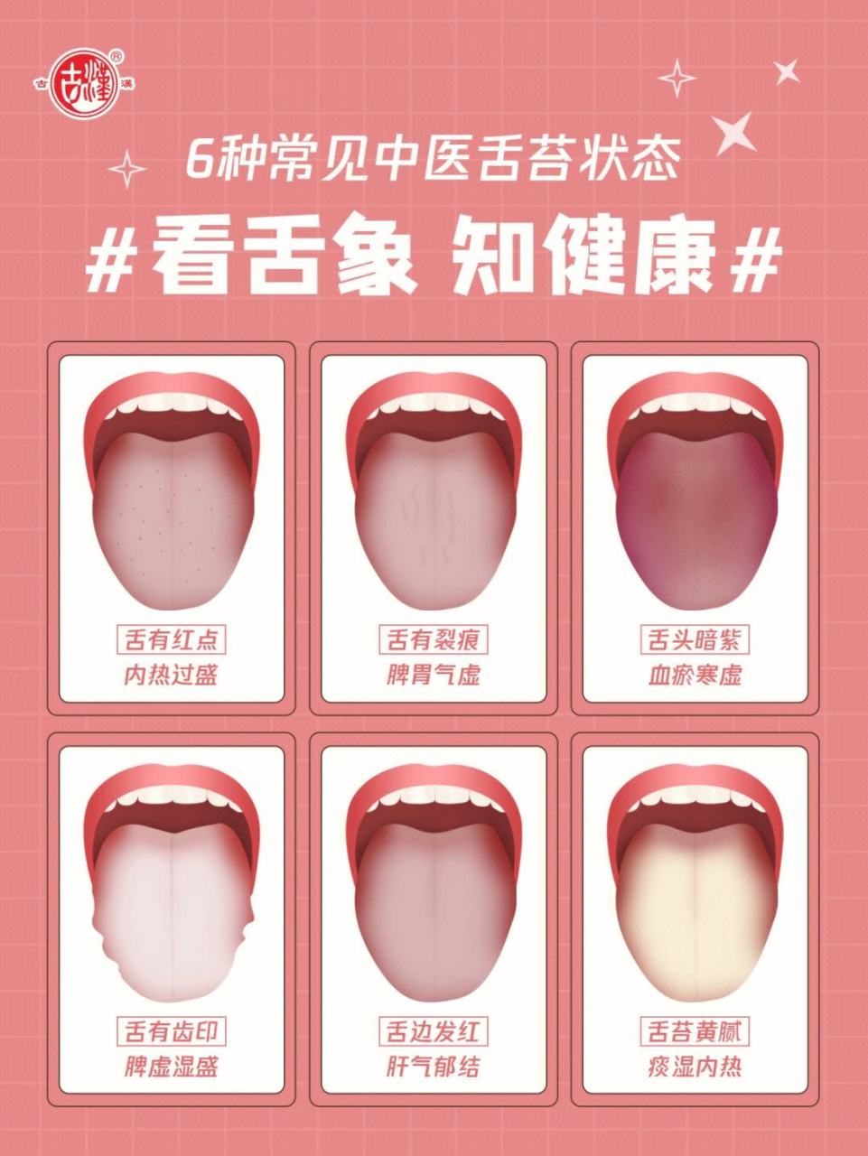 中医为什么要看舌诊? 舌头是人体健康的一面镜子,舌头上的颜色,结节,