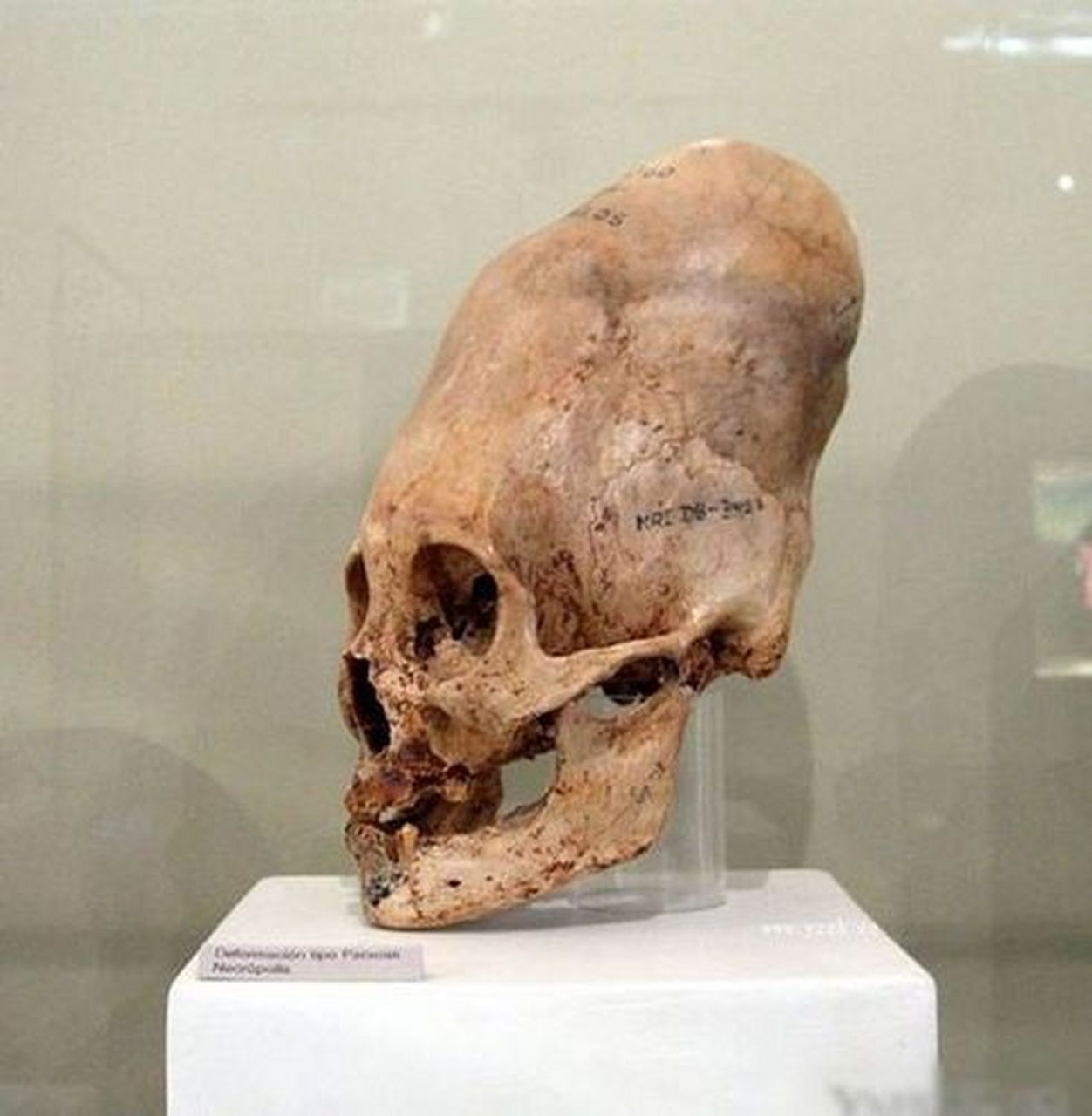 世界上最神秘的头骨·帕拉卡斯头骨 1928年,秘鲁考古学家胡里奥·特洛