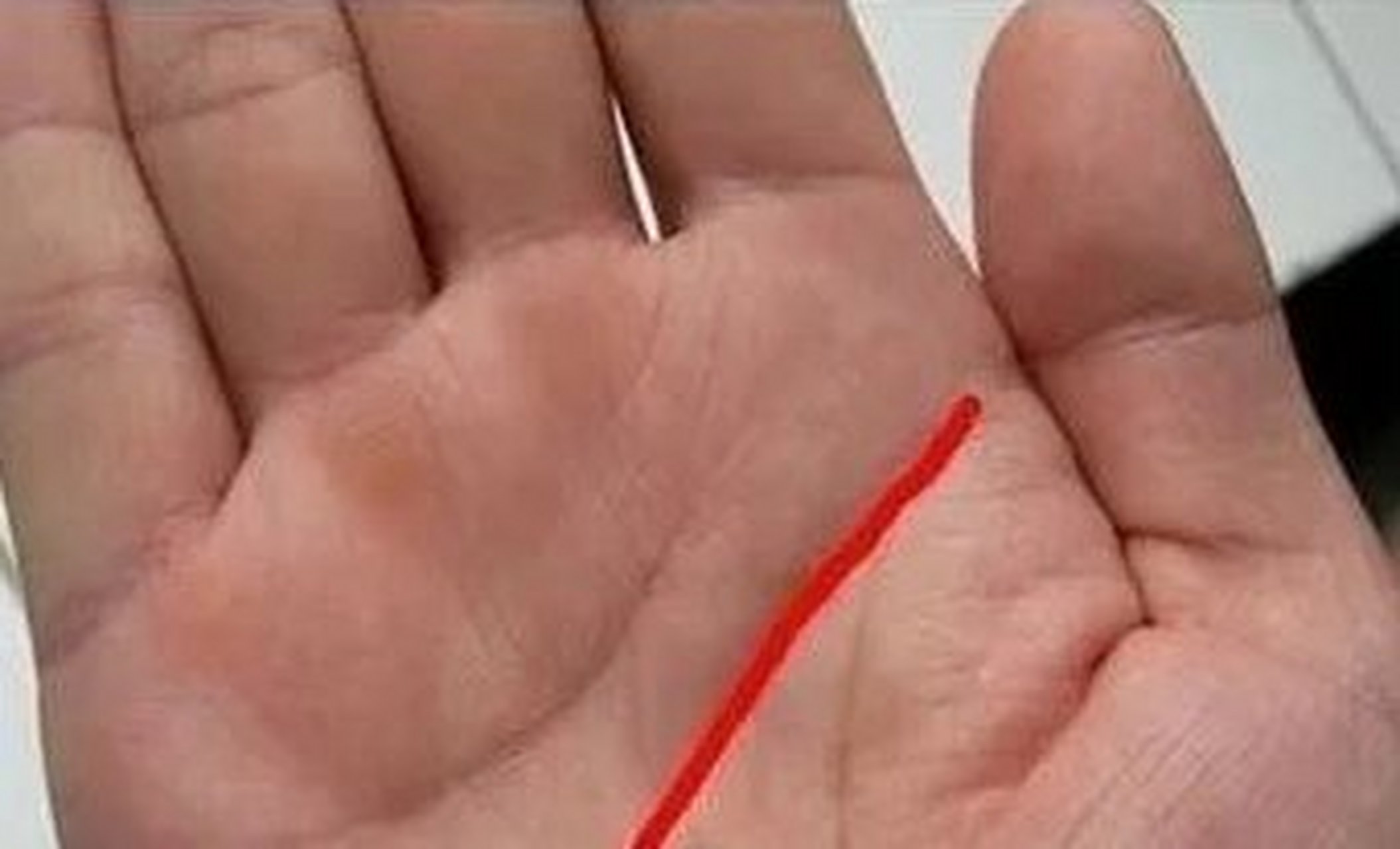 当手掌的生命线上有明显的横纹时,就意味着这个人的健康存在一定的