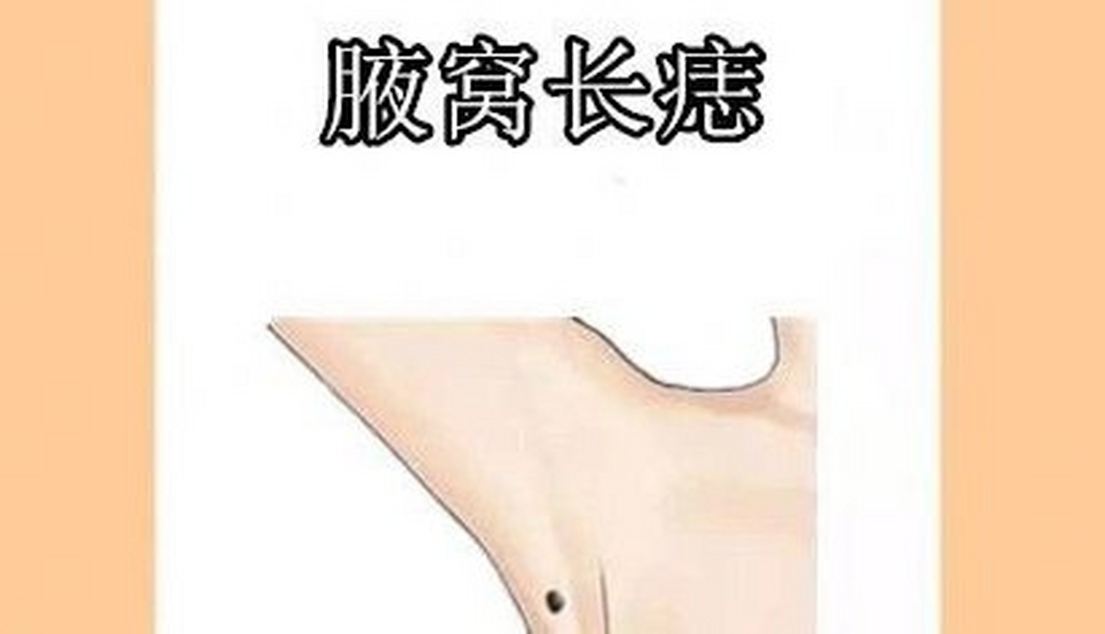 在相学当中,若是一个人的腋窝处的位置长有吉痣,则会被称之"金匮痣"