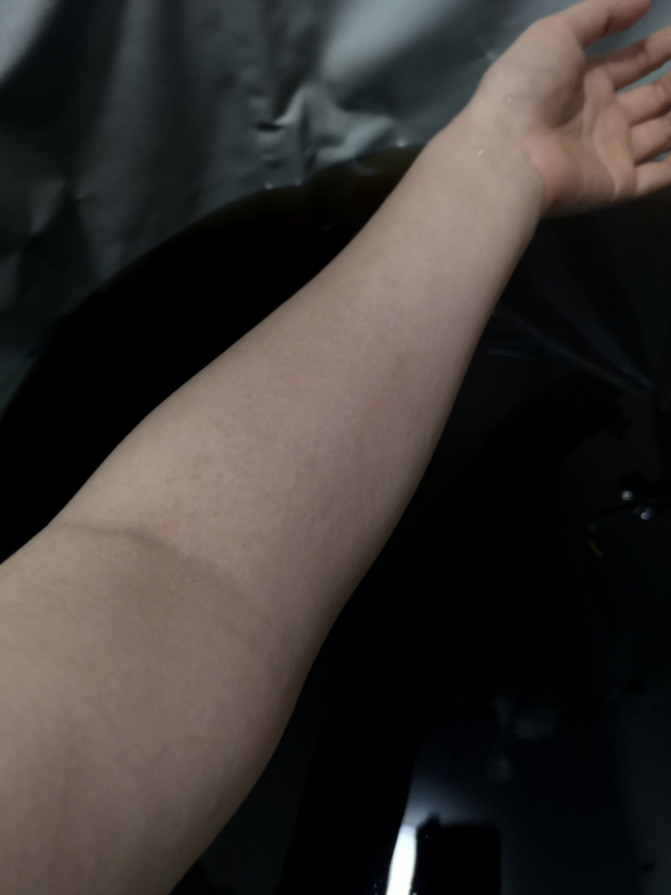 过敏性体质,酒精过敏者.