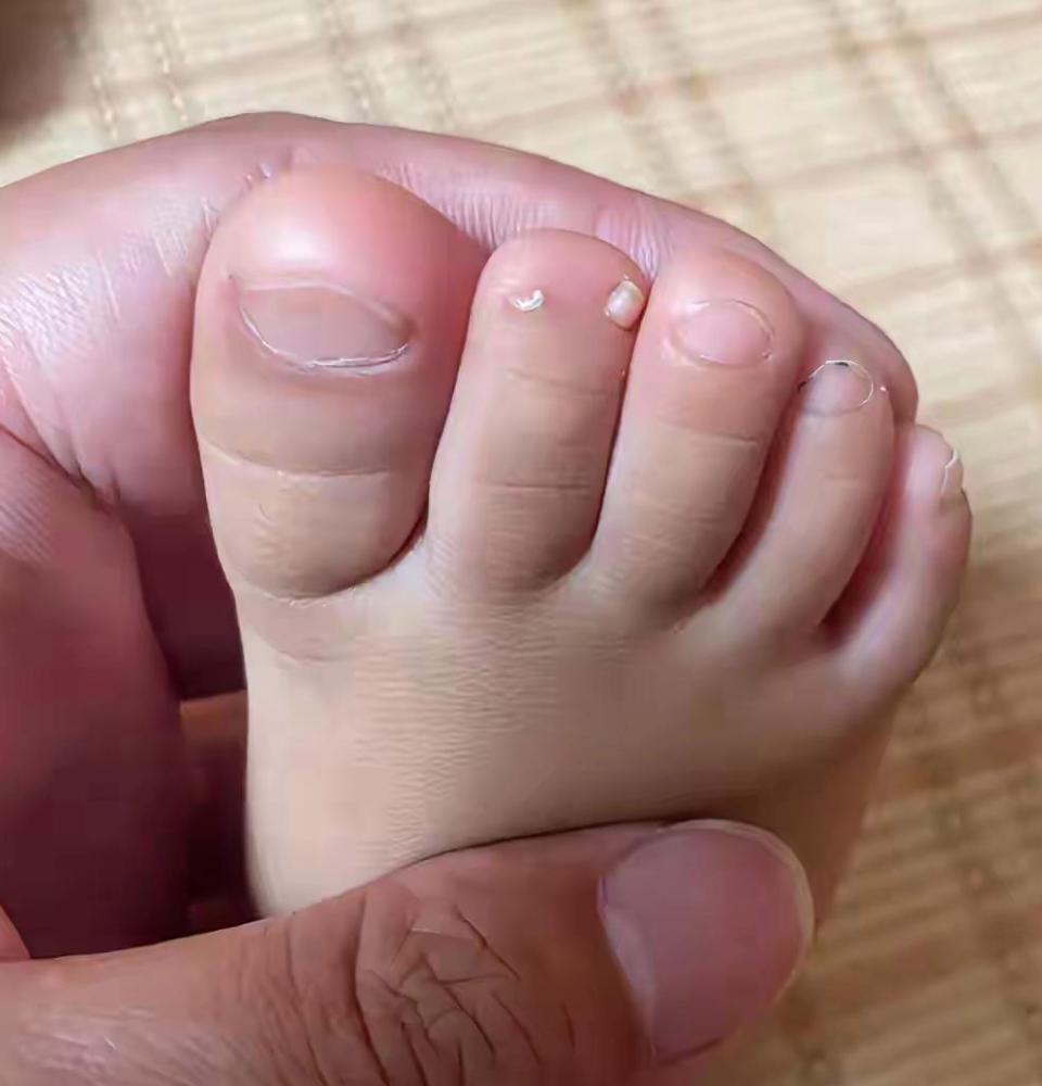 看这肉嘟嘟的小脚趾好可爱呀!可是怎么就长了两个指甲盖呢?