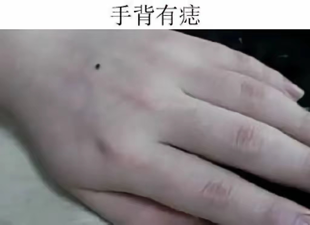手背痣:自带幸运光环,人生之路顺遂平坦