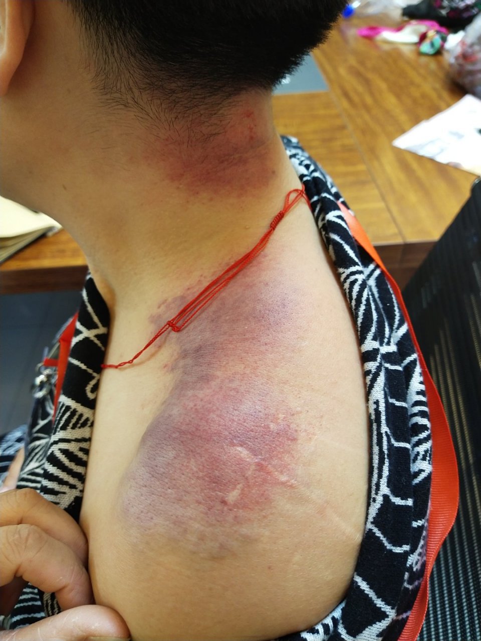 古法经络调理三经一脉