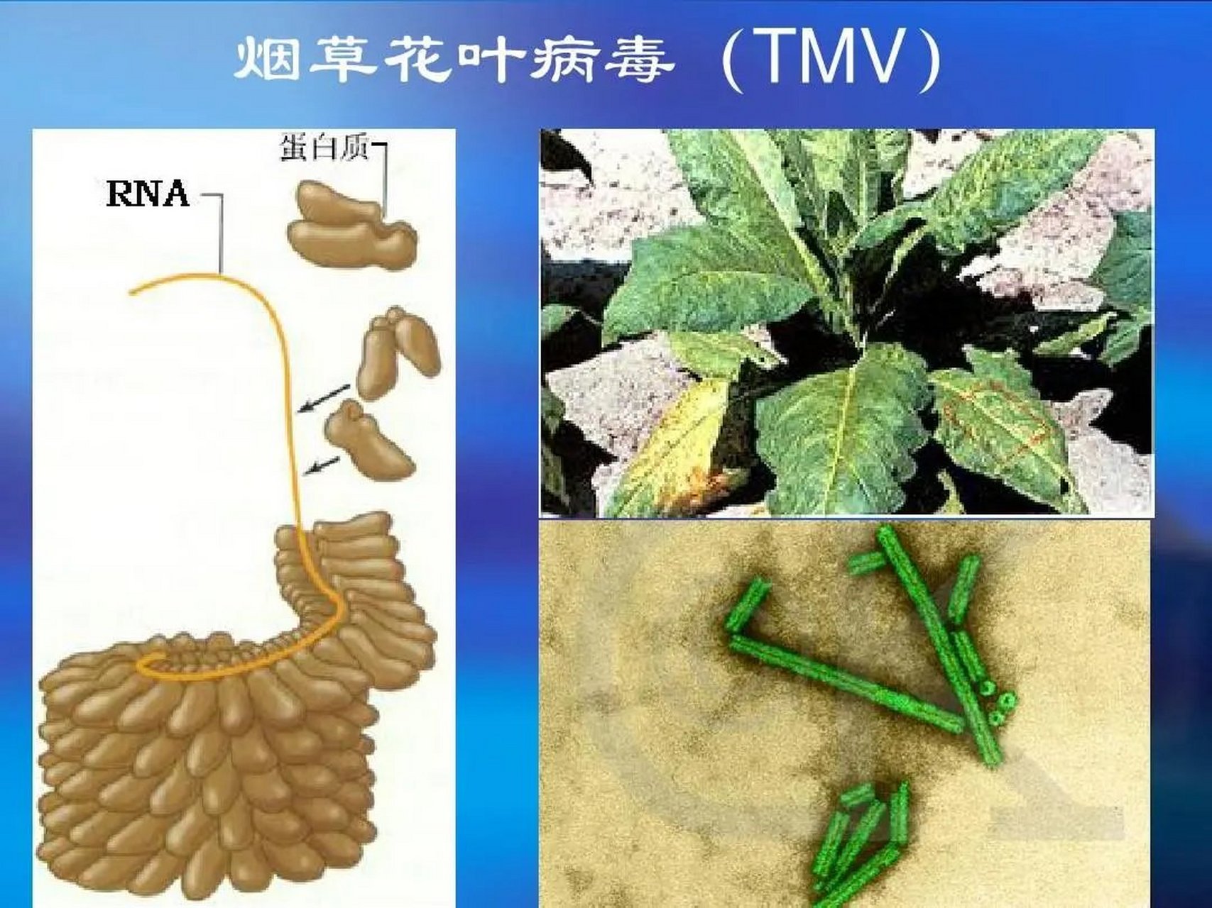 【医学史上的6月20日:俄国细菌学家伊凡诺夫斯基去世,人类首次发现