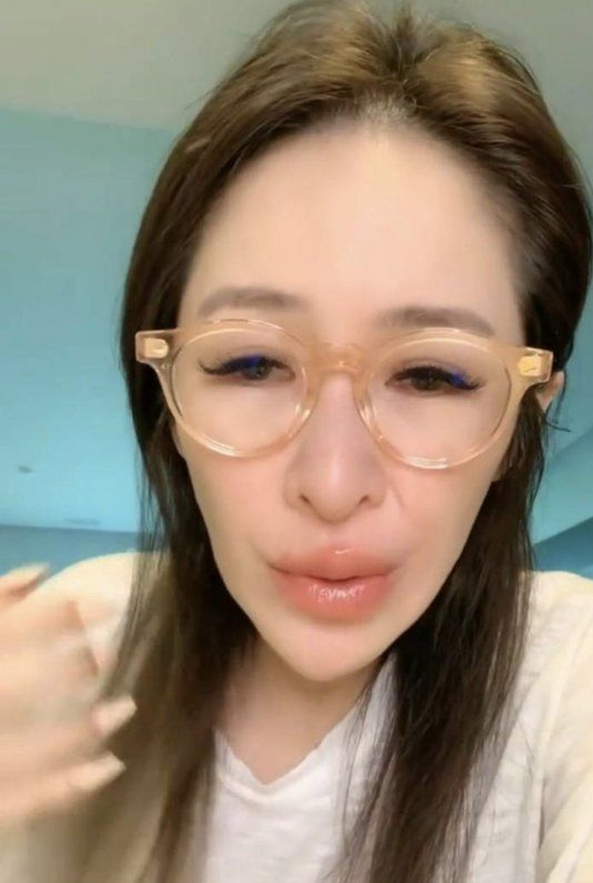 整容真不是小事情!